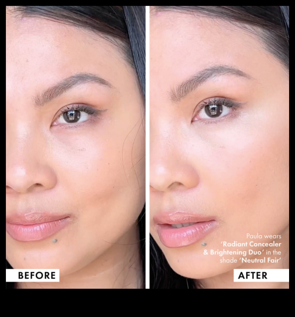 קורנים ומוכנים: קונסילרים מאירים לזוהר זוהר