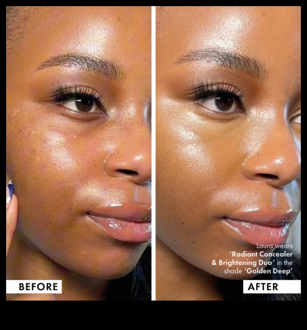 קורנים ומוכנים: קונסילרים מאירים לזוהר זוהר