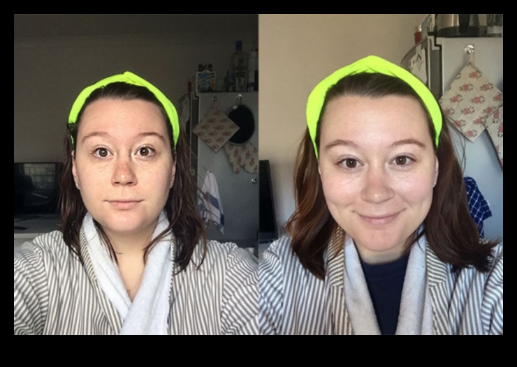 השפעת התזונה הקטוגנית על בריאות העור