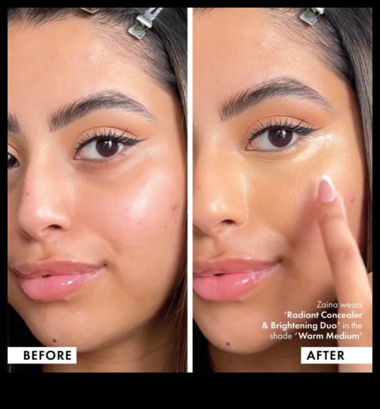 קורנים ומוכנים: קונסילרים מאירים לזוהר זוהר